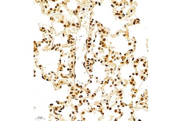 RBM45 antibody