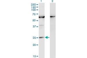 Western Blot analysis of KCNIP1 expression in transfected 293T cell line by KCNIP1 monoclonal antibody (M10), clone 3D9. (KCNIP1 antibody  (AA 1-216))