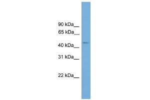 WB Suggested Anti-C11orf16 Antibody Titration: 0. (C11ORF16 antibody  (Middle Region))