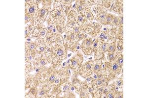 Immunohistochemistry of paraffin-embedded human liver injury using ST3GAL3 antibody (ABIN5974085) at dilution of 1/100 (40x lens). (ST3GAL3 antibody)