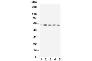 Western blot testing of GRB7 antibody and Lane 1:  rat testis (GRB7 antibody  (Middle Region))