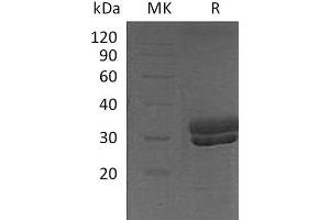 Western Blotting (WB) image for Kallikrein 7 (KLK7) protein (His tag) (ABIN7320700) (Kallikrein 7 Protein (KLK7) (His tag))