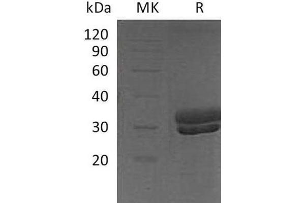 Kallikrein 7 Protein (KLK7) (His tag)