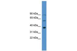 Image no. 1 for anti-Paired-Like Homeodomain 1 (PITX1) (AA 160-209) antibody (ABIN6745407) (PITX1 antibody  (AA 160-209))