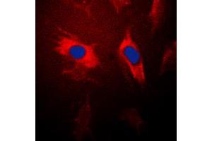 Immunofluorescent analysis of 14-3-3 theta staining in HeLa cells. (14-3-3 theta antibody  (Center))