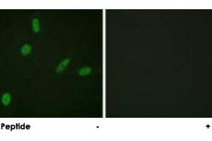 Immunofluorescence analysis of HeLa cells, using ETS1 polyclonal antibody . (ETS1 antibody)