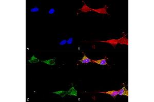 Immunocytochemistry/Immunofluorescence analysis using Mouse Anti-Ataxin 1 Monoclonal Antibody, Clone S65-37 (ABIN1741521). (Ataxin 1 antibody  (AA 746-761))