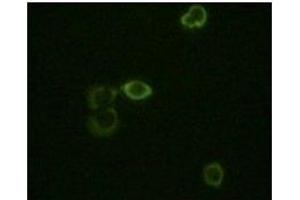 Immunofluorescence staining of methanol-fixed Hela cells using ABL2 mouse mAb showing cytoplasm localization. (ABL2 antibody)