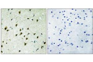 Immunohistochemistry analysis of paraffin-embedded human brain tissue, using MAD4 antibody. (MXD4 antibody  (N-Term))