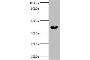 Western blot All lanes: Cytoplasmic protein NCK1 antibody at 4 μg/mL + Rat liver tissue Secondary Goat polyclonal to rabbit IgG at 1/10000 dilution Predicted band size: 43, 36 kDa Observed band size: 43 kDa (NCK1 antibody  (AA 58-377))