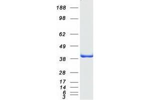 Chloride Intracellular Channel 5 (CLIC5) (Transcript Variant 2) protein (Myc-DYKDDDDK Tag)