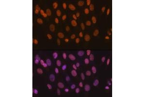 Immunofluorescence (IF) image for anti-SWI/SNF Related, Matrix Associated, Actin Dependent Regulator of Chromatin, Subfamily A, Member 5 (SMARCA5) antibody (ABIN7270656)