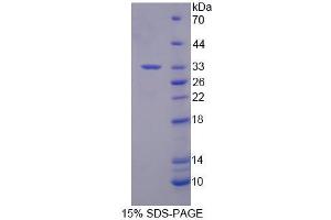 SDS-PAGE (SDS) image for Regulator of G-Protein Signaling 3 (RGS3) (AA 1-261) protein (His tag) (ABIN6239417) (RGS3 Protein (AA 1-261) (His tag))