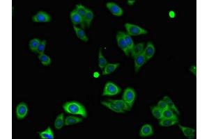 Immunofluorescent analysis of HepG2 cells using ABIN7160827 at dilution of 1:100 and Alexa Fluor 488-congugated AffiniPure Goat Anti-Rabbit IgG(H+L) (NLRP3 antibody  (AA 30-102))