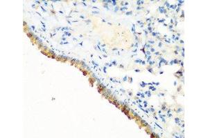 Immunohistochemistry of paraffin-embedded Mouse lung using CBL Polyclonal Antibody at dilution of 1:200 (40x lens). (CBL antibody)