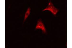 ABIN6267366 staining Hela cells by IF/ICC. (BCR antibody  (pTyr177))