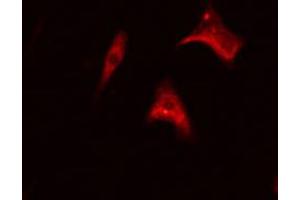 ABIN6267366 staining Hela cells by IF/ICC.