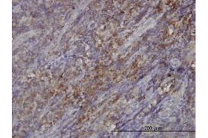 Image no. 1 for anti-RAS Guanyl Releasing Protein 4 (RASGRP4) (AA 574-674) antibody (ABIN599321) (RASGRP4 antibody  (AA 574-674))