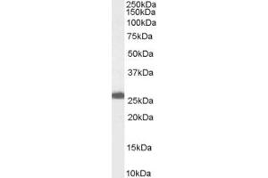 Western Blotting (WB) image for anti-Progesterone Receptor Membrane Component 1 (PGRMC1) (C-Term) antibody (ABIN2466103) (PGRMC1 antibody  (C-Term))
