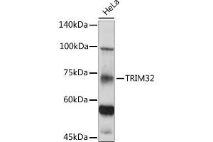 Western blot analysis of extracts of HeLa cells, using TRIM32 antibody (ABIN6132735, ABIN6149520, ABIN6149521 and ABIN6222878) at 1:500 dilution. (TRIM32 antibody  (AA 1-280))
