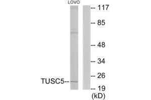 TUSC5 anticorps