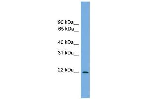 WB Suggested Anti-Jundm2 Antibody Titration:  0. (JDP2 antibody  (N-Term))