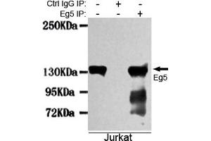 Immunoprecipitation analysis of Jurkat cell lysates using Eg5 mouse mAb. (KIF11 antibody)