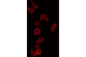 ABIN6274971 staining RAW264. (CPN1 antibody  (C-Term))