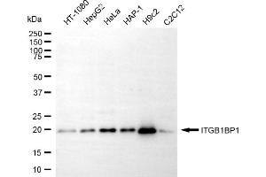 Western blotting analysis using ITGB1BP1 antibody (ABIN7799068).