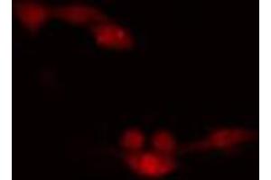ABIN6266648 staining HeLa cells by IF/ICC. (CDK7 antibody  (Internal Region))