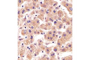 Immunohistochemical analysis of paraffin-embedded H. (TFIP11 antibody  (N-Term))