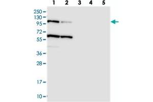 Western blot analysis of Lane 1: RT-4, Lane 2: U-251 MG, Lane 3: Human Plasma, Lane 4: Liver, Lane 5: Tonsil with USP6NL polyclonal antibody .