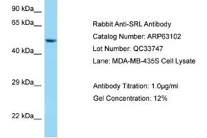 Western Blotting (WB) image for anti-Sarcalumenin (SRL) (C-Term) antibody (ABIN2789371) (Sarcalumenin antibody  (C-Term))