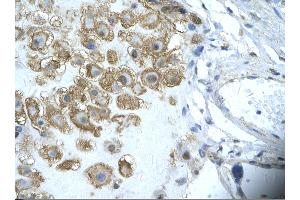 Rabbit Anti-ENO1 Antibody       Paraffin Embedded Tissue:  Human placenta cell   Cellular Data:  Epithelial cells of renal tubule  Antibody Concentration:   4. (ENO1 antibody  (Middle Region))