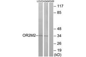 Western blot analysis of extracts from LOVO/A549 cells, using OR2M2 Antibody. (OR2M2 antibody  (AA 281-330))