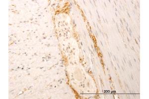 Immunoperoxidase of monoclonal antibody to SYT1 on formalin-fixed paraffin-embedded human smooth muscle. (SYT1 antibody  (AA 1-422))
