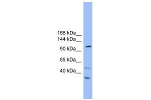 Western Blot showing STARD8 antibody used at a concentration of 1. (STARD8 antibody  (N-Term))