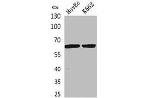 Western Blot analysis of HuvEc, K562 cells using OAT1 Polyclonal Antibody. (SLC22A6 antibody  (N-Term))