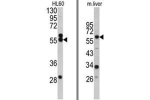 (LEFT) Western blot analysis of HMGCS1 antibody (Center) in HL60 cell line lysates (35ug/lane). (HMGCS1 antibody  (Middle Region))