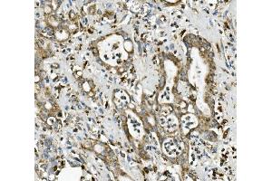 IHC analysis of ME2 using anti-ME2 antibody (ABIN7600967). (NAD-ME antibody  (AA 26-584))