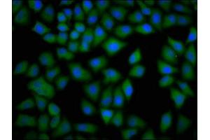 Immunofluorescence staining of Hela cells with ABIN7149364 at 1:133, counter-stained with DAPI. (CKAP4 antibody  (AA 260-394))