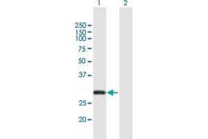Western Blot analysis of CITED2 expression in transfected 293T cell line by CITED2 MaxPab polyclonal antibody. (CITED2 antibody  (AA 1-270))