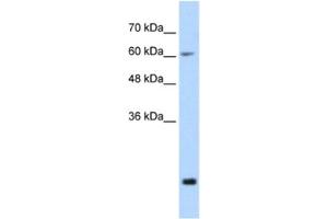 Western Blotting (WB) image for anti-Fused in Sarcoma (FUS) antibody (ABIN2462078) (FUS antibody)