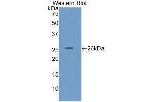 Western Blotting (WB) image for anti-Lipase, Hepatic (LIPC) (AA 25-247) antibody (ABIN1859670) (LIPC antibody  (AA 25-247))