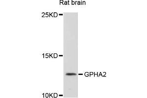 Western blot analysis of extracts of rat brain cells, using GPHA2 antibody.