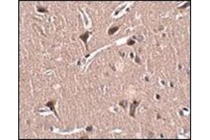 Immunohistochemistry of MIPU1 in human brain tissue with this product at 2. (ZNF667 antibody  (N-Term))