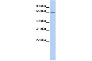 WB Suggested Anti-ACOT12 Antibody Titration: 0. (ACOT12 antibody  (Middle Region))