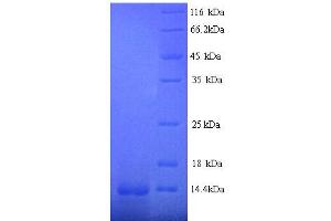 SDS-PAGE (SDS) image for Early Growth Response 1 (EGR1) (AA 444-543), (partial) protein (His tag) (ABIN5713418) (EGR1 Protein (AA 444-543, partial) (His tag))