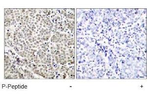 Image no. 1 for anti-Nuclear Factor-kB p65 (NFkBP65) (pSer529) antibody (ABIN196955) (NF-kB p65 antibody  (pSer529))