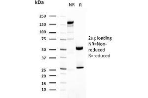 SDS-PAGE Analysis Purified Uroplakin 1A Mouse Monoclonal Antibody (UPK1A/2921). (UPK1A antibody  (AA 114-173))